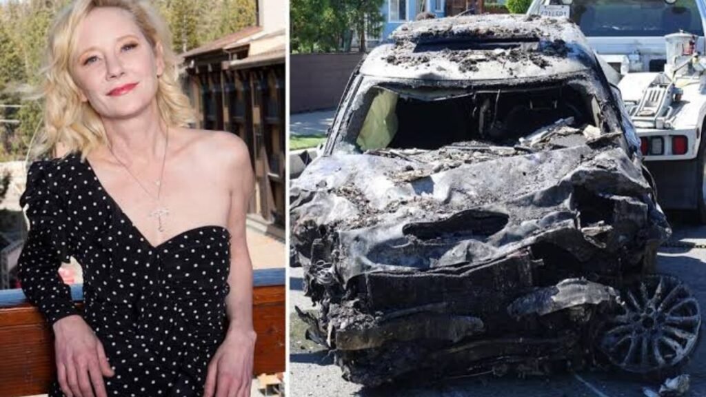 Anne Heche Death and Cause of Death